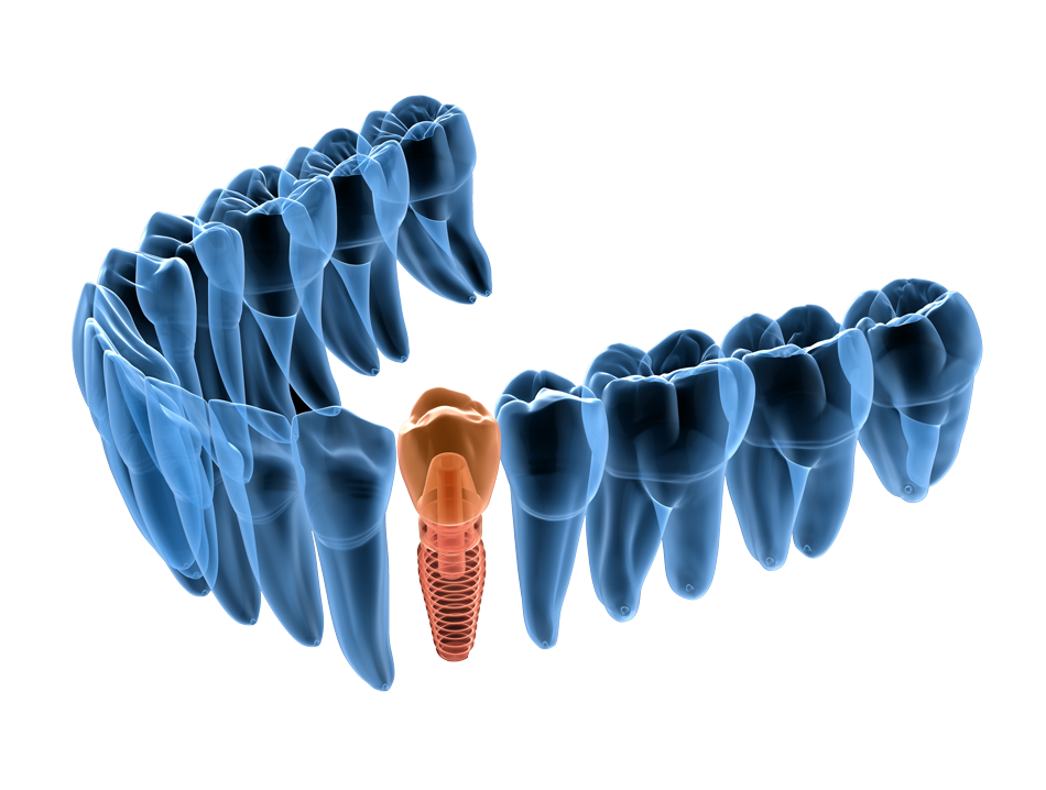 digital dentistry teeth
